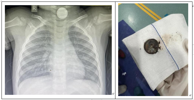 1726131624820.png 1726131624820.png